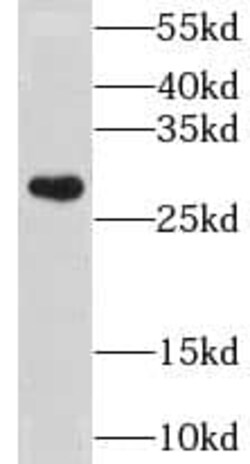 CLIC3 Antibody - BSA Free, Novus Biologicals 100 &mu;g | Buy Online | Novus Biologicals | Fisher Scientific