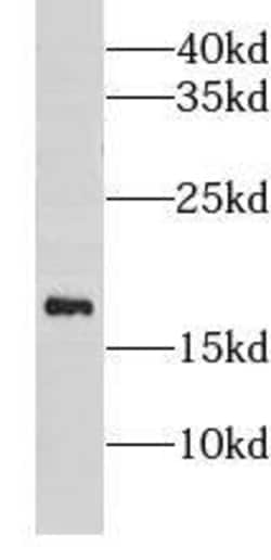 CISD1 Antibody - BSA Free, Novus Biologicals 100 &mu;g | Buy Online | Novus Biologicals | Fisher Scientific