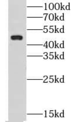 CHST14 Antibody - BSA Free, Novus Biologicals 100 &mu;g; Unconjugated:Antibodies,