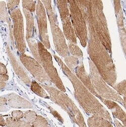 Nicotinic Acetylcholine R alpha 1/CHRNA1 Antibody - BSA Free, Novus Biologicals 100 &mu;g | Buy Online | Novus Biologicals | Fisher Scientific