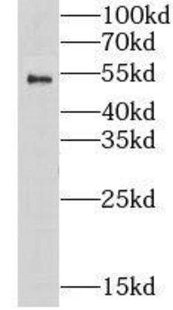 Nicotinic Acetylcholine R alpha 1/CHRNA1 Antibody - BSA Free, Novus Biologicals 100 &mu;g | Buy Online | Novus Biologicals | Fisher Scientific