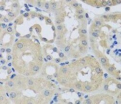CHMP1B Antibody - BSA Free, Novus Biologicals 100 &mu;g | Buy Online | Novus Biologicals | Fisher Scientific