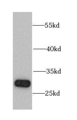 CHMP1B Antibody - BSA Free, Novus Biologicals 100 &mu;g | Buy Online | Novus Biologicals | Fisher Scientific