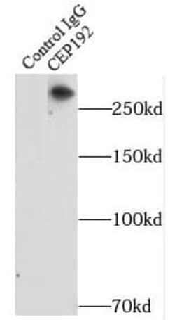 CEP192 Antibody - BSA Free, Novus Biologicals 100 &mu;g | Buy Online | Novus Biologicals | Fisher Scientific