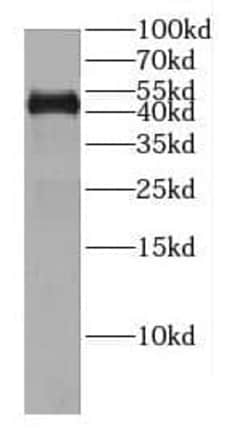 CENPL Antibody - BSA Free, Novus Biologicals 100 &mu;g | Buy Online | Novus Biologicals | Fisher Scientific