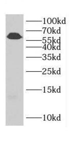 Cadherin-23 Antibody - BSA Free, Novus Biologicals 100 &mu;g | Buy Online | Novus Biologicals | Fisher Scientific