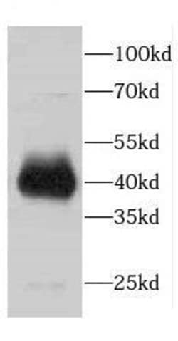 CDCA7 Antibody - BSA Free, Novus Biologicals 100 &mu;g | Buy Online | Novus Biologicals | Fisher Scientific