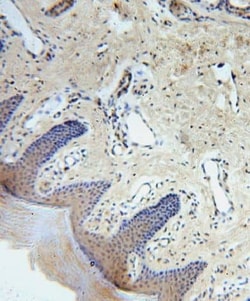 CCDC72 Antibody - BSA Free, Novus Biologicals 100 &mu;g | Buy Online | Novus Biologicals | Fisher Scientific