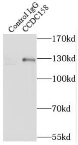 CCDC158 Antibody - BSA Free, Novus Biologicals 100 &mu;g | Buy Online | Novus Biologicals | Fisher Scientific