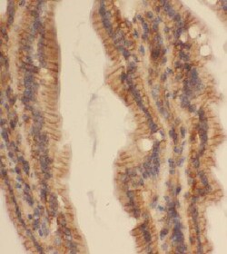 CCDC120 Antibody - BSA Free, Novus Biologicals 100 &mu;g | Buy Online | Novus Biologicals | Fisher Scientific