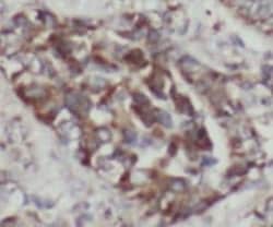 CC2D2A Antibody - BSA Free, Novus Biologicals 100 &mu;g; Unconjugated:Antikroppar