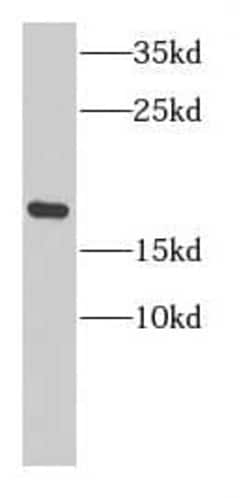 CBP20 Antibody - BSA Free, Novus Biologicals 100 &mu;g | Buy Online | Novus Biologicals | Fisher Scientific
