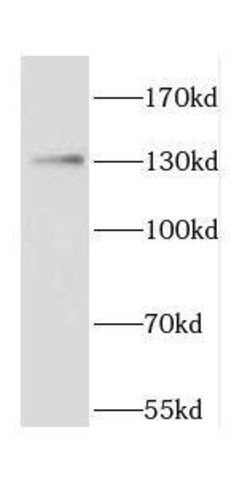 CARD6 Antibody - BSA Free, Novus Biologicals 100 &mu;g | Buy Online | Novus Biologicals | Fisher Scientific