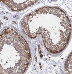 CARD6 Antibody - BSA Free, Novus Biologicals 100 &mu;g | Buy Online | Novus Biologicals | Fisher Scientific