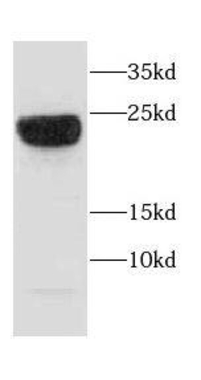 Capsl Pbm Rx CAPSL Antibody - BSA Free, Novus Biologicals 100 μg; Unconjugated ...