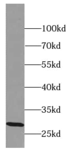 EQTN Antibody - BSA Free, Novus Biologicals 100 &mu;g | Buy Online | Novus Biologicals | Fisher Scientific