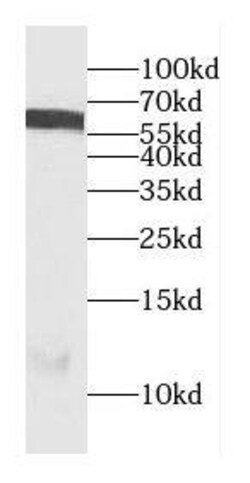 CEP85L Antibody - BSA Free, Novus Biologicals 100 &mu;g | Buy Online | Novus Biologicals | Fisher Scientific