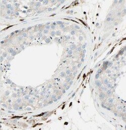 CEP85L Antibody - BSA Free, Novus Biologicals 100 &mu;g | Buy Online | Novus Biologicals | Fisher Scientific