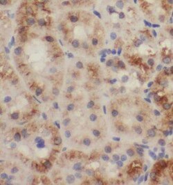 TRAPPC13 Antibody - BSA Free, Novus Biologicals 100 &mu;g | Buy Online | Novus Biologicals | Fisher Scientific