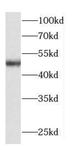 TRAPPC13 Antibody - BSA Free, Novus Biologicals 100 &mu;g | Buy Online | Novus Biologicals | Fisher Scientific