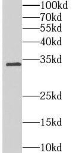 OSAP Antibody - BSA Free, Novus Biologicals 100 &mu;g | Buy Online | Novus Biologicals | Fisher Scientific