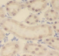 KANSL1L Antibody - BSA Free, Novus Biologicals 100 &mu;g | Buy Online | Novus Biologicals | Fisher Scientific