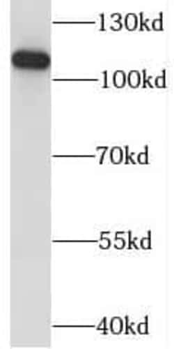 KANSL1L Antibody - BSA Free, Novus Biologicals 100 &mu;g | Buy Online | Novus Biologicals | Fisher Scientific
