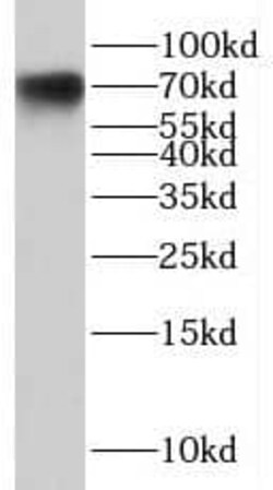 CNBD2 Antibody - BSA Free, Novus Biologicals 100 &mu;g | Buy Online | Novus Biologicals | Fisher Scientific