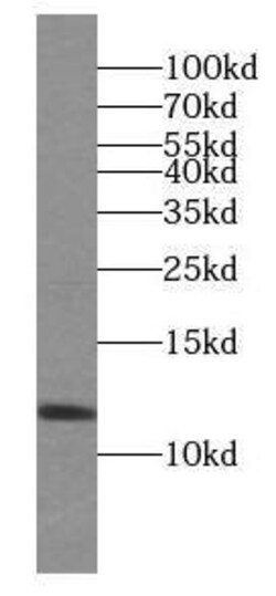 PPDPF Antibody - BSA Free, Novus Biologicals 100 &mu;g | Buy Online | Novus Biologicals | Fisher Scientific