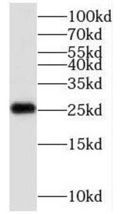 C1orf50 Antibody - BSA Free, Novus Biologicals 100 &mu;g | Buy Online | Novus Biologicals | Fisher Scientific