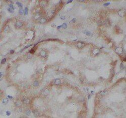 C1orf50 Antibody - BSA Free, Novus Biologicals 100 &mu;g | Buy Online | Novus Biologicals | Fisher Scientific