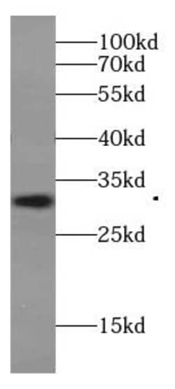 IZUMO4 Antibody - BSA Free, Novus Biologicals 100 &mu;g | Buy Online | Novus Biologicals | Fisher Scientific