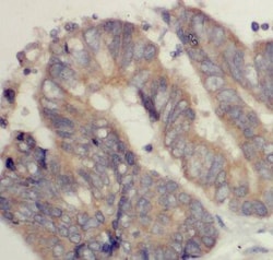 Mic1 Antibody - BSA Free, Novus Biologicals 100 &mu;g | Buy Online | Novus Biologicals | Fisher Scientific