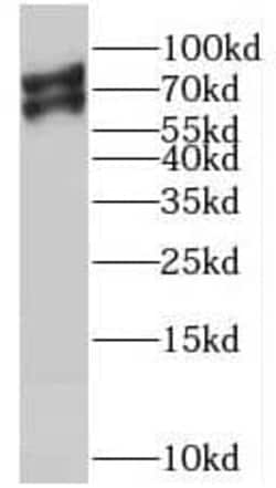 Mic1 Antibody - BSA Free, Novus Biologicals 100 &mu;g | Buy Online | Novus Biologicals | Fisher Scientific