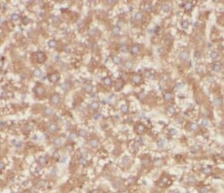 TIM21 Antibody - BSA Free, Novus Biologicals 100 &mu;g | Buy Online | Novus Biologicals | Fisher Scientific
