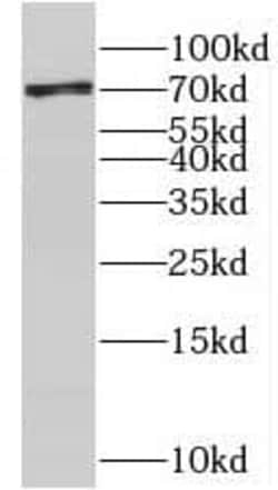 NCBP3 Antibody - BSA Free, Novus Biologicals 100 &mu;g | Buy Online | Novus Biologicals | Fisher Scientific