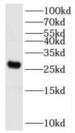 KATNBL1 Antibody - BSA Free, Novus Biologicals 100 &mu;g | Buy Online | Novus Biologicals | Fisher Scientific