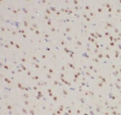 KATNBL1 Antibody - BSA Free, Novus Biologicals 100 &mu;g | Buy Online | Novus Biologicals | Fisher Scientific