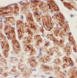 CCDC4 Antibody - BSA Free, Novus Biologicals 100 &mu;g | Buy Online | Novus Biologicals | Fisher Scientific