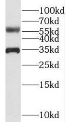 CCDC4 Antibody - BSA Free, Novus Biologicals 100 &mu;g | Buy Online | Novus Biologicals | Fisher Scientific