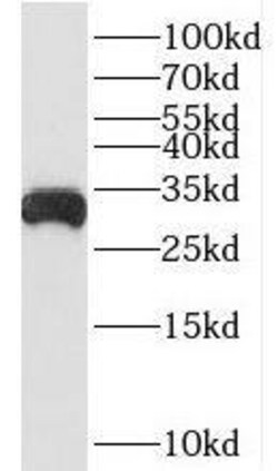 BDH1 Antibody - BSA Free, Novus Biologicals 100 &mu;g | Buy Online | Novus Biologicals | Fisher Scientific