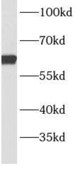 BBS9 Antibody - BSA Free, Novus Biologicals 100 &mu;g | Buy Online | Novus Biologicals | Fisher Scientific