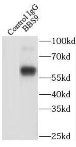 BBS9 Antibody - BSA Free, Novus Biologicals 100 &mu;g | Buy Online | Novus Biologicals | Fisher Scientific