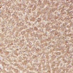 BBS9 Antibody - BSA Free, Novus Biologicals 100 &mu;g | Buy Online | Novus Biologicals | Fisher Scientific