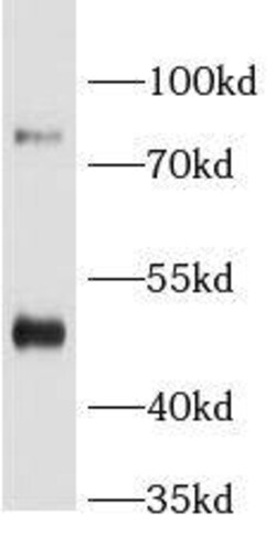 BAAT Antibody - BSA Free, Novus Biologicals 100 &mu;g | Buy Online | Novus Biologicals | Fisher Scientific