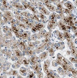 BAAT Antibody - BSA Free, Novus Biologicals 100 &mu;g | Buy Online | Novus Biologicals | Fisher Scientific