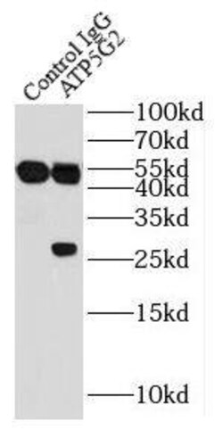 ATP5G2 Antibody - BSA Free, Novus Biologicals 100 &mu;g | Buy Online | Novus Biologicals | Fisher Scientific