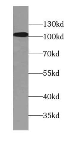 ATP13A1 Antibody - BSA Free, Novus Biologicals 100 &mu;g | Buy Online | Novus Biologicals | Fisher Scientific