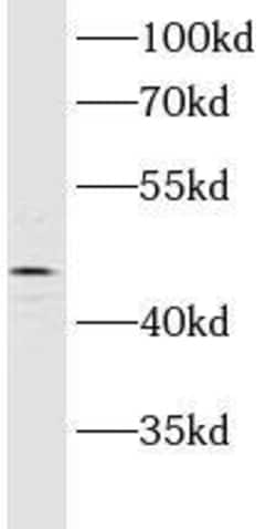 ASCC1 Antibody - BSA Free, Novus Biologicals&trade;