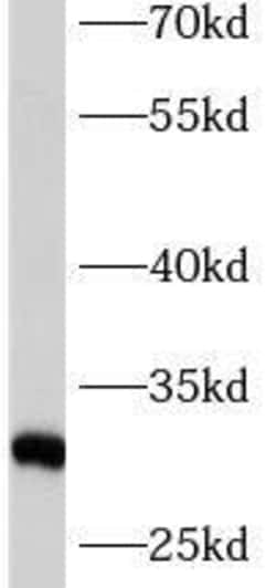 ASB9 Antibody - BSA Free, Novus Biologicals 100 &mu;g | Buy Online | Novus Biologicals | Fisher Scientific